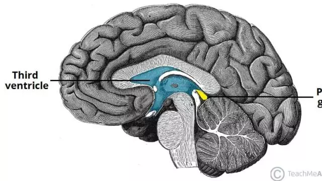 ⬆️🧠‍⬆️The Truth about Pineal Gland Activation - This Is Really Amazing